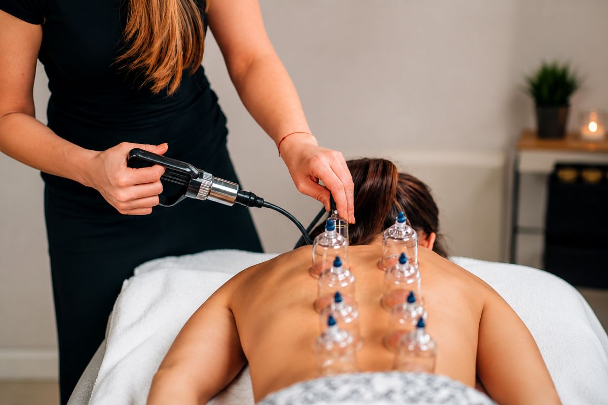 Terapeutkinja izvodi cupping tretman vakuumskim pištoljem na leđima klijentice, uz više postavljenih čašica