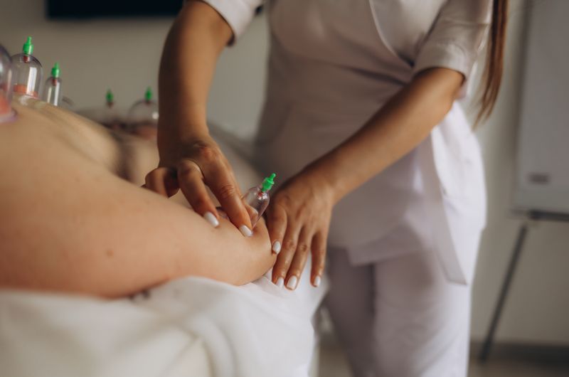 Cupping tretman u kozmetičkom salonu za njegu tijela i opuštanje