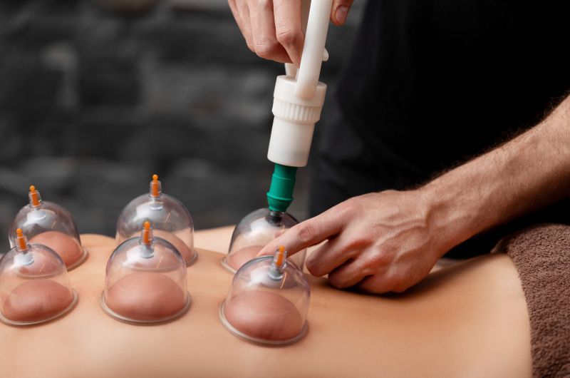 Maser izvodi cupping masažu pomoću staklenih čašica na leđima klijenta