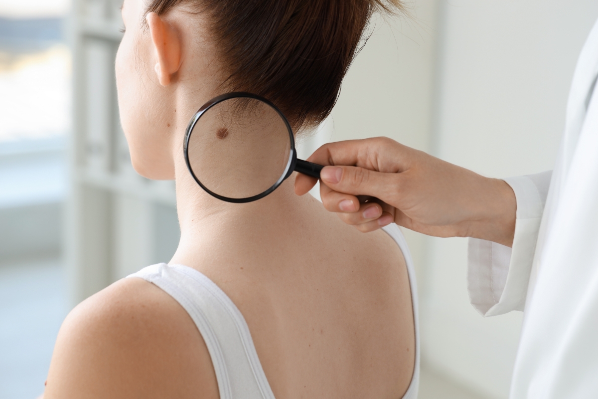 devojka na pregledu mladeža kod dermatologa