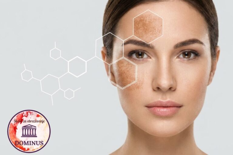 Lice osobe s vidljivim hiperpigmentacijskim promjenama na čelu i obrazu prikazano je uz grafičke elemente koji simboliziraju dermatološku analizu kože i estetske tretmane.